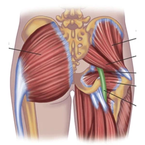 Sciatica Piriformis Syndrome Massage